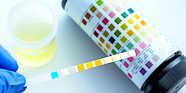 analyse urine glyphosate